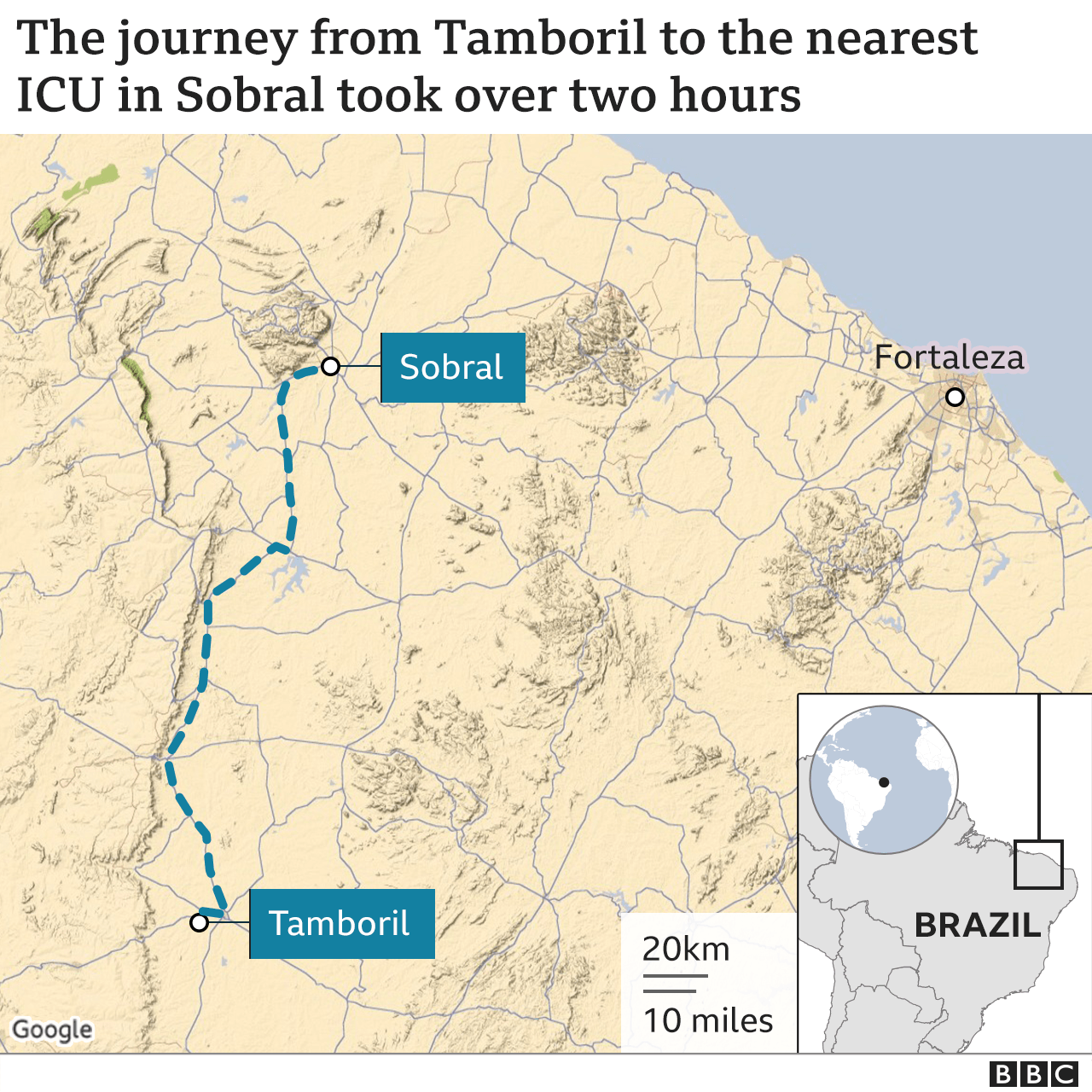 118017133_brazil_child_transferred_icu_map2x640-nc